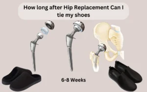 how long after hip replacement can I tie my shoes