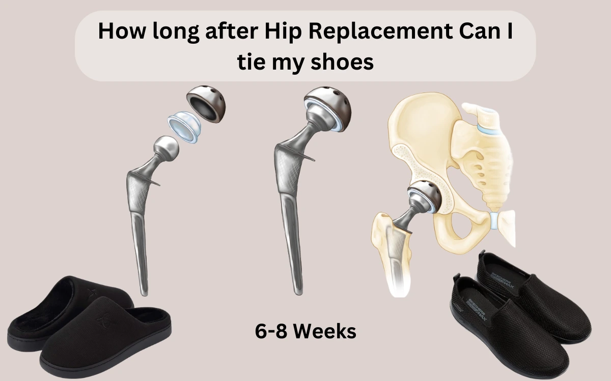 how long after hip replacement can I tie my shoes